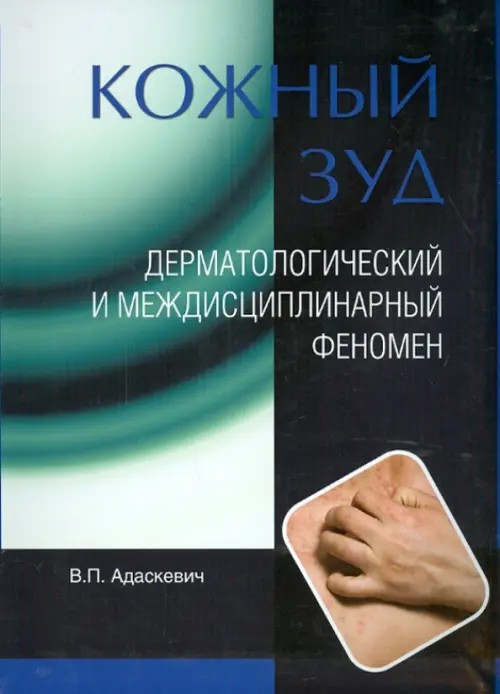 Кожный зуд: Дерматологический и междисциплинарный феномен
