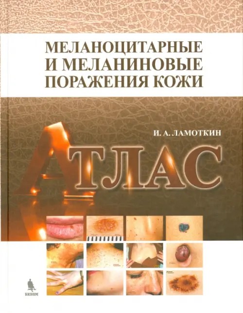 Меланоцитарные и меланиновые поражения кожи: Атлас