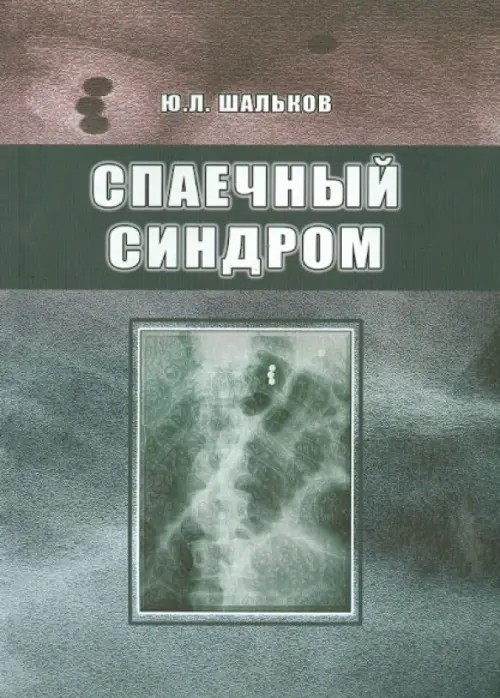 Спаечный синдром