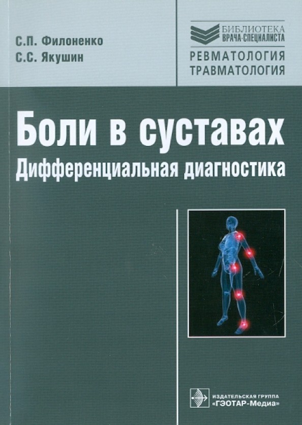 Боли в суставах: дифференциальная диагностика