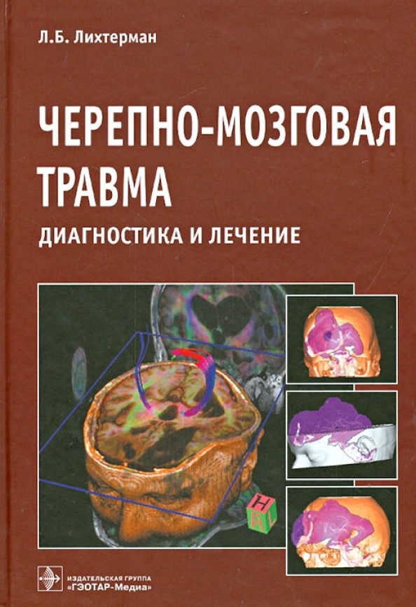 Черепно-мозговая травма: Диагностика и лечение