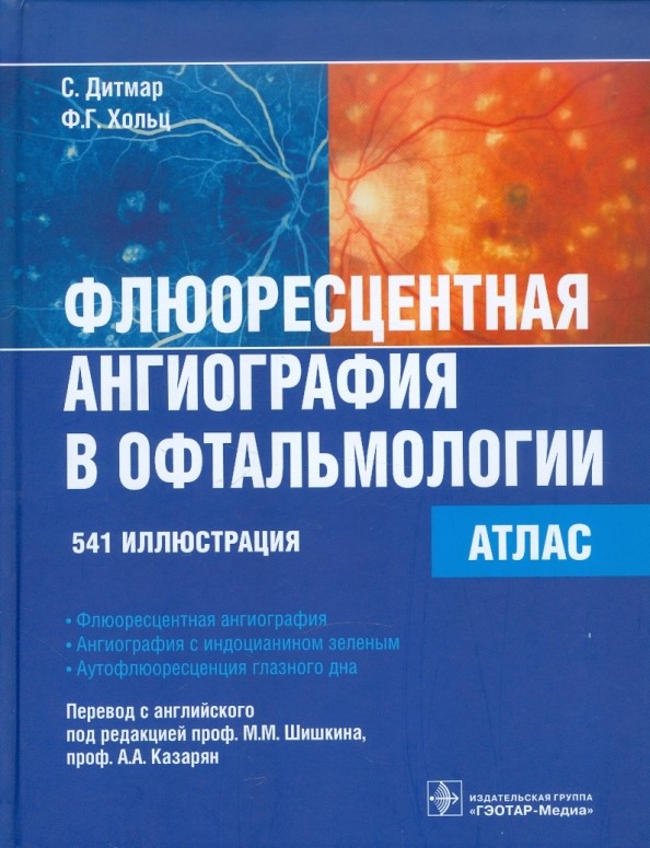 Флюоресцентная ангиография в офтальмологии: Атлас