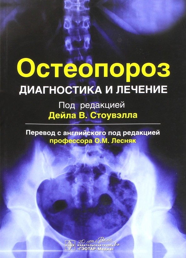Остеопороз: Диагностика и лечение