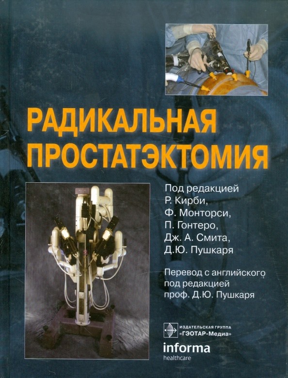 Радикальная простатэктомия