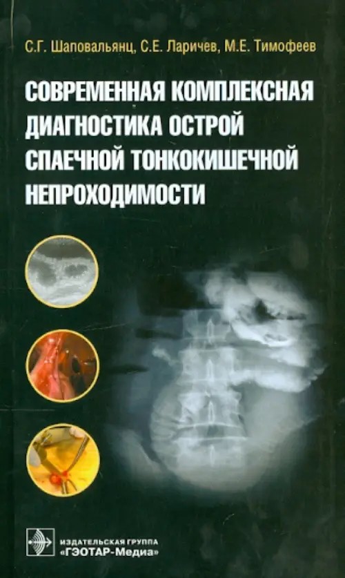 Современная комплексная диагностика острой спаечной тонкокишечной непроходимости
