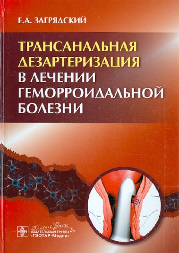 Трансанальная дезартеризация в лечении геморроидальной болезни: Руководство
