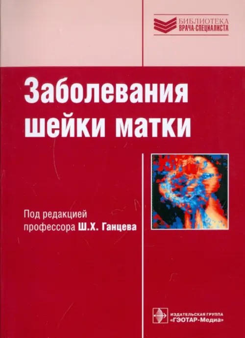 Заболевания шейки матки: Руководство