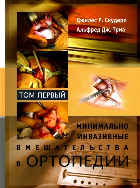 Минимально инвазивные вмешательства в ортопедии: В 2 томах. Том 1