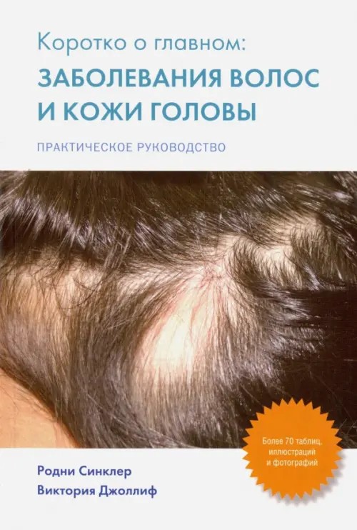 Коротко о главном: заболевание волос и кожи головы: Практическое руководство